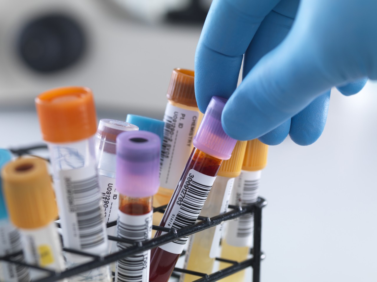 一致性评价大幕开启，医院市场即将调整