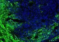 结合力量！溶瘤病毒与CAR-T打开攻克实体瘤难题的新思路