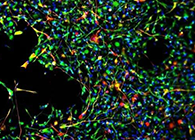 世界初创：药物将干细胞疏导至受损部位，提高其愈合能力！