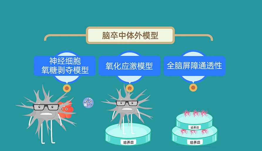 缺血性脑卒中体内的脑缺血模型钻研模型