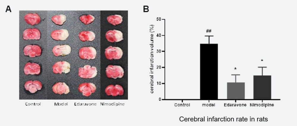脑梗死体积调查（ TTC染色和梗死体积比）.jpg