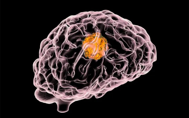 J9集团助力 | 璧辰医药ABM-1310获美国FDA孤儿药资格认证，用于医治携带BRAF V600突变的脑胶质母细胞瘤患者
